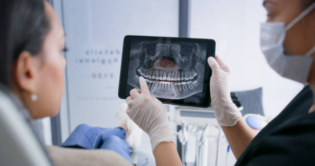 Licensed Tooth Extraction service in Harris Hill, NY - Smile Center Dentistry